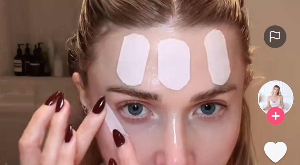 Geger Tren Face Taping Disebut Botoks Alami Tanpa Jarum! Ini Faktanya Menurut Ahli Kulit