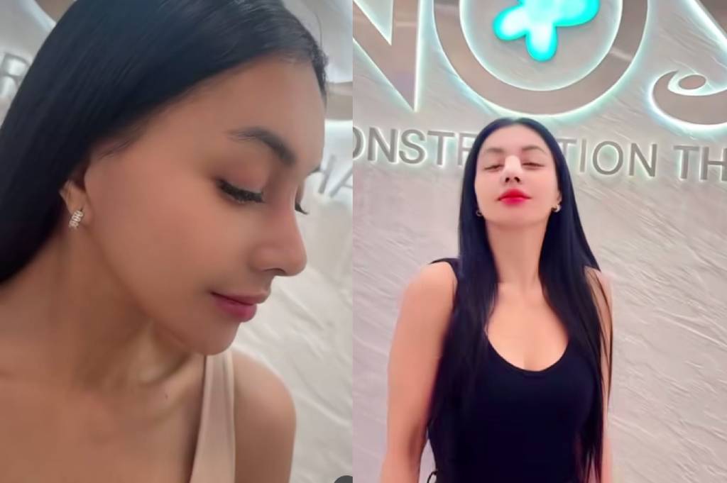 3 Fakta Denada Oplas: Transformasi, Alasan dan Biaya yang Mengejutkan