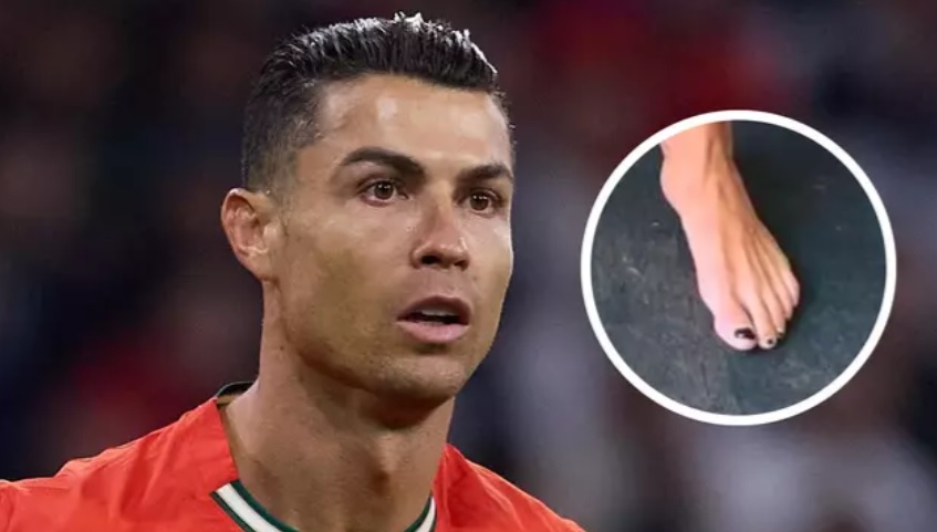 Viral Cristiano Ronaldo Cat Kuku Kaki Hitam Ikuti Mike Tyson, Alasannya Mengejutkan!