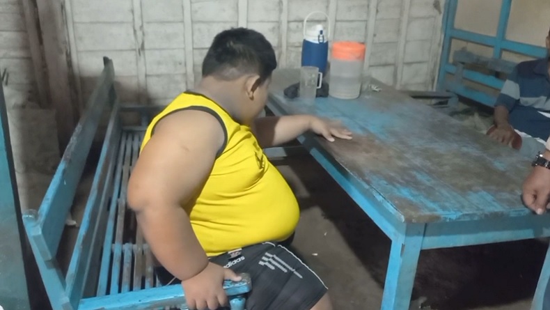 Kisah Pilu Bocah di Tuban Tak Bisa Sekolah dan Main Bersama Teman karena Obesitas 