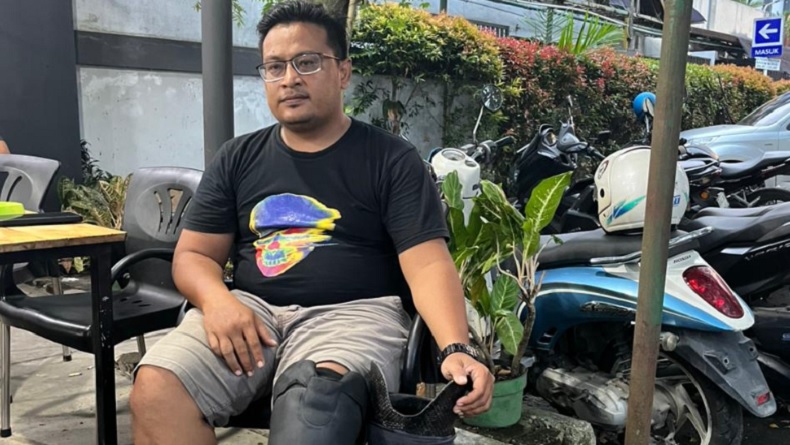 Kisah Pilu Kurir di Medan, Dipecat Setelah Kehilangan Kaki akibat Kecelakaan Saat Antar Paket
