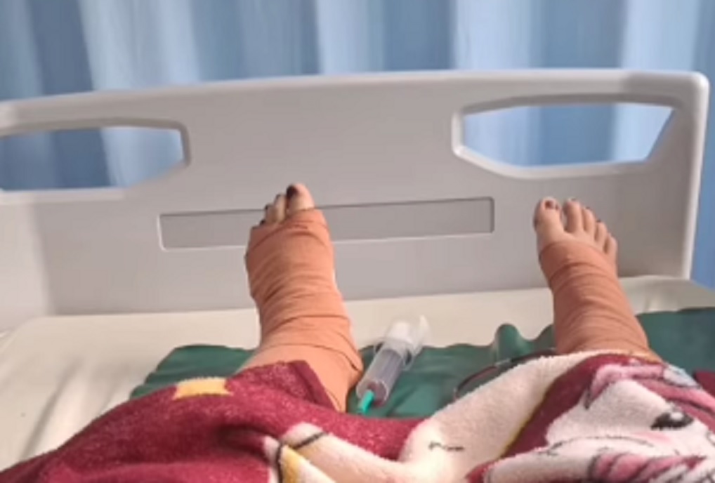 Kondisi Terkini Perempuan Lompat dari Lantai 19 Apartemen Kalibata, Tubuh Luka-Luka