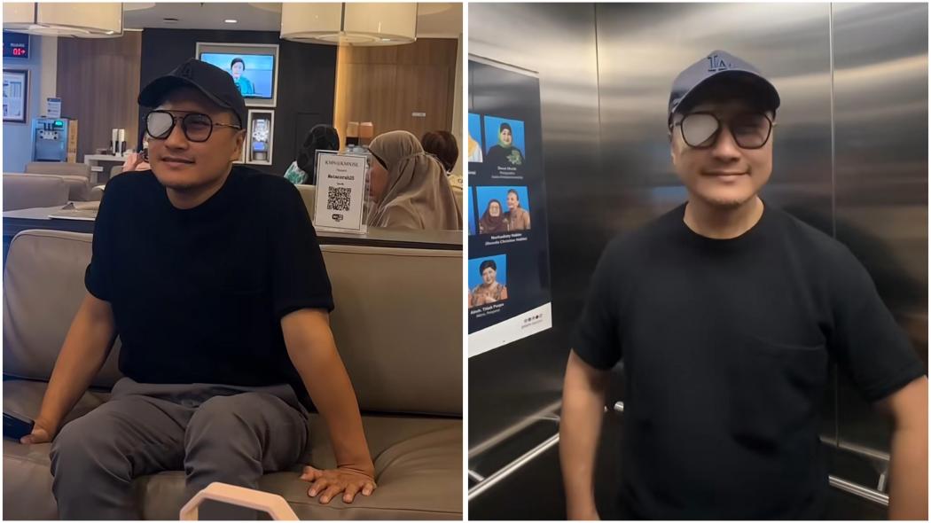 Arie Untung Tiba-Tiba Dilarikan ke Rumah Sakit dengan Mata Diperban, Ini Penyebabnya! 