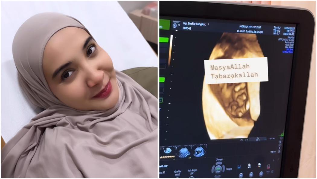 Zaskia Sungkar Hamil Lagi, Suara Detak Jantung Bikin Terharu