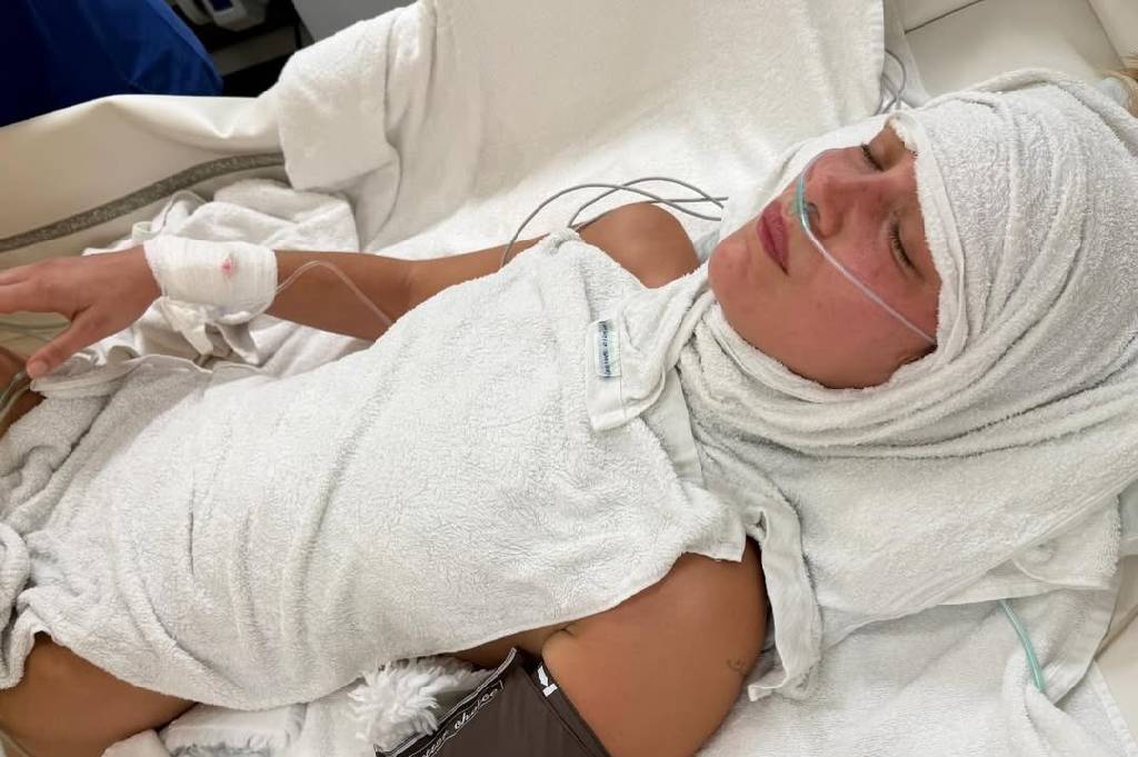 Bella Hadid Sakit Parah, Kondisi Terkini Memprihatinkan