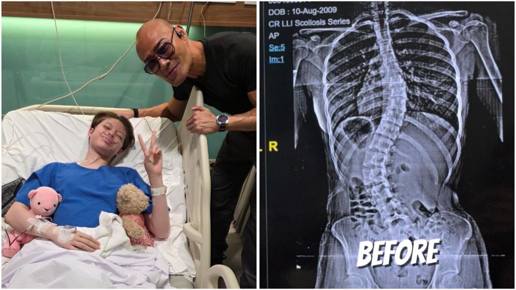 Nada Anak Deddy Corbuzier Jalani Operasi Skoliosis, 12 Hari Dirawat di RS