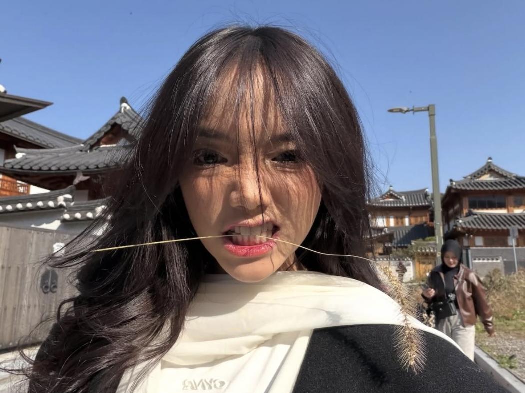 Fuji Didiagnosis ADHD, Dilarang Makan Cokelat Banyak-Banyak!