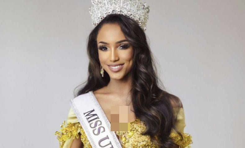 Jatuh dari Panggung Ajang Miss Universe, Miss Jamaika Gabrielle Masih Dirawat di ICU