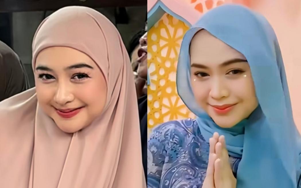 Ria Ricis Akui Operasi Hidung, Alasannya Idap Gangguan Pernapasan 5 Tahun