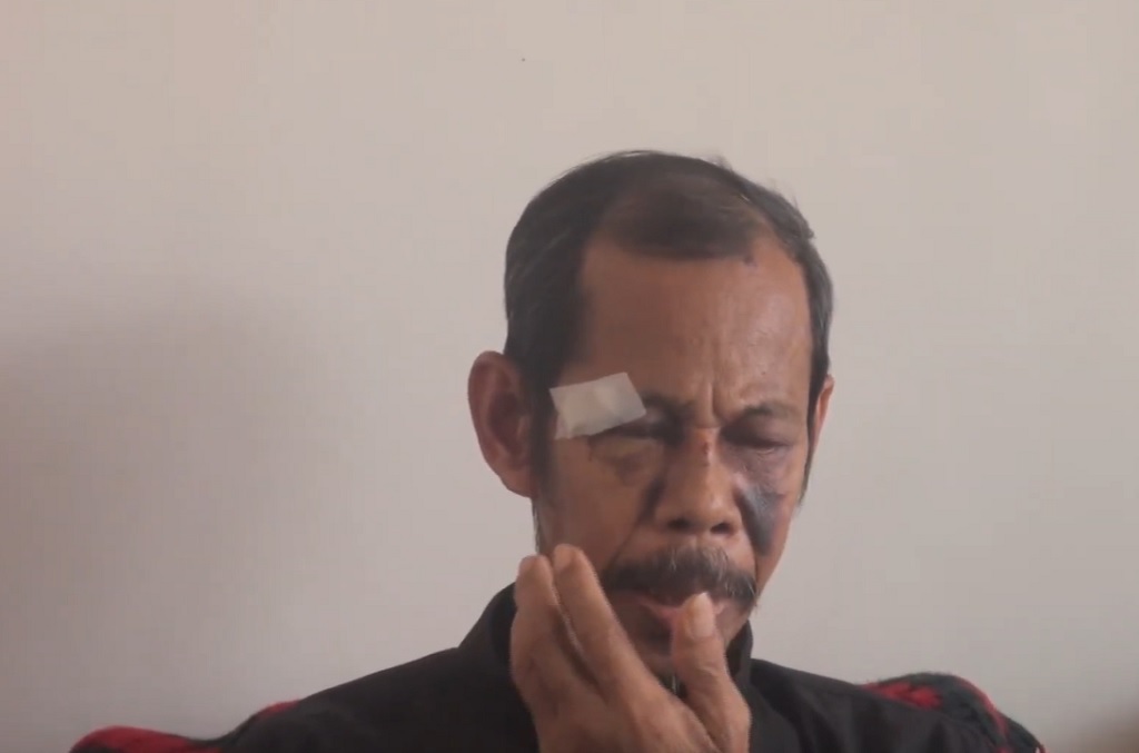 Miris! Imam Masjid di Palopo Babak Belur Dikeroyok, Kini Malah Dilaporkan Balik ke Polisi