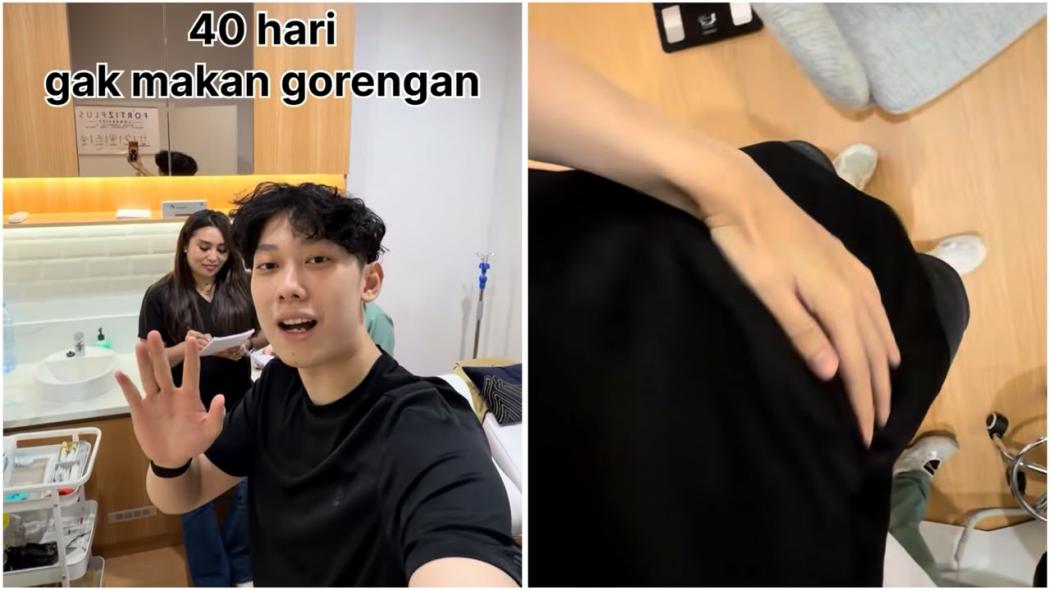Stop Makan Gorengan 40 Hari, Willie Salim Klaim Lemak Turun 5,8 Kg!