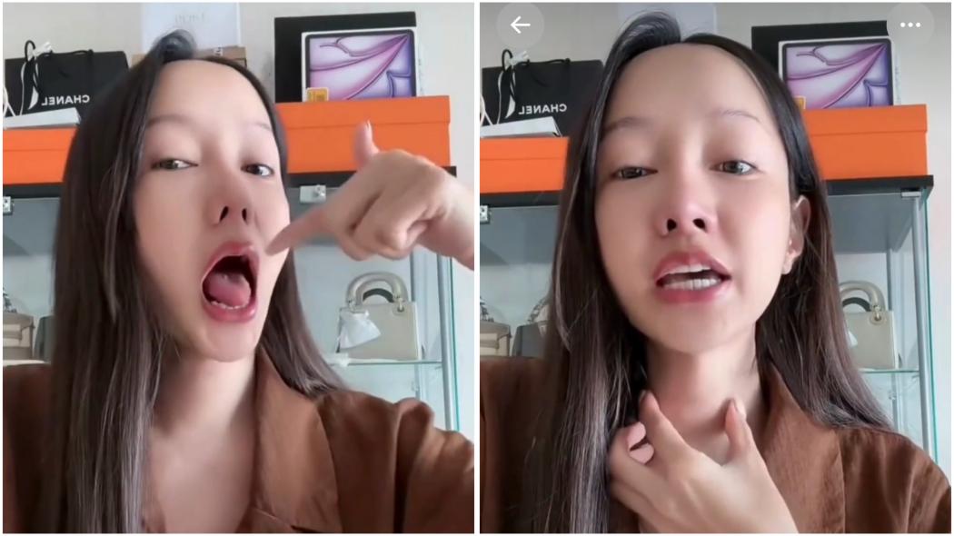 Wajib Tahu! Ini 8 Risiko Operasi Pita Suara seperti Dilakukan Lucinta Luna