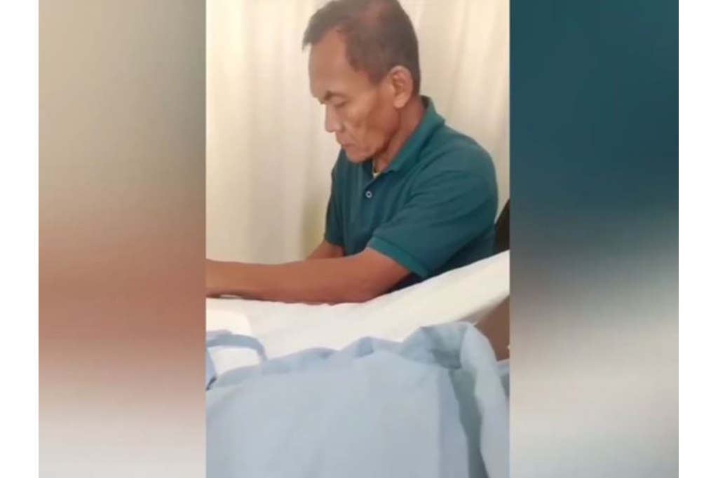 Jelang Operasi Rekonstruksi Wajah Korban YTR, RSHS Bandung Fokus Redakan Infeksi