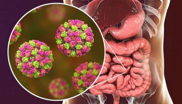 Fakta Fakta Norovirus Virus Mematikan Pemicu Infeksi Usus Akut Bagian All