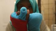 Khofifah Kunjungi Perempuan Pengidap Gangguan Jiwa Pemakan Jari Sendiri