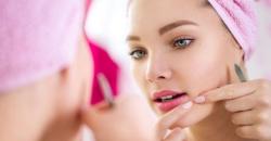 Malu Ada Bekas Jerawat di Wajah, Hilangkan dengan Cara Ini