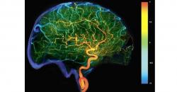 Dipecat IDI, Ini Metode Cuci Otak Dokter Terawan