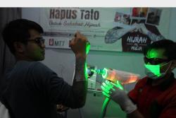 Melihat Proses Menghilangkan Tato di Badan