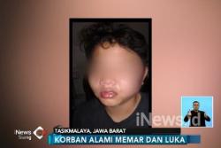 Dianiaya Senior di Pesantren, 2 Santri Junior Babak Belur