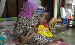 Azkiya Bocah 5 Tahun Penderita Hidrosefalus Butuh Bantuan