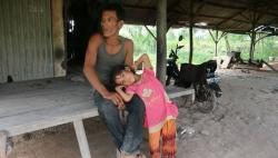 Bocah Pengidap Tumor Ganas Tunggu Uluran Tangan Pemerintah