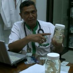 Cacing Pita Terpanjang di Dunia Ditemukan di Tubuh Warga Simalungun<