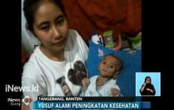 Ironis 25 Anak Gizi Buruk di Wilayah Dekat Ibu Kota