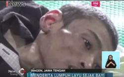 Potret Kemiskinan, Derita Pria Pengidap Lumpuh Layu di Sragen