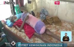 Derita TBC Kronis, Kondisi Gadis 16 Tahun Ini Mengkhawatirkan