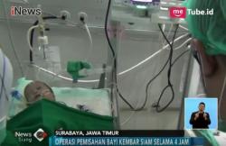 Kondisi Memburuk, Tim Dokter Berhasil Pisahkan Bayi Kembar Siam