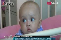 Orang Tua Tak Sanggup Beli Susu, Bayi Alami Gizi Buruk
