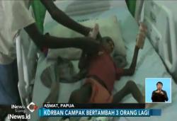 Wabah Campak di Asmat, Total Korban Bertambah 600 Orang