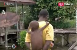 Sempat Menolak, 2 Balita Pengidap Campak Dirujuk ke RSUD Agats