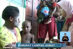 Kondisi Memprihatinkan, Tim Polda Bantu Obat dan Makanan di Papua