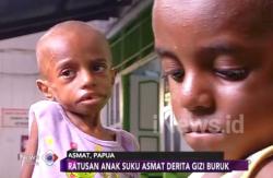 Masalah Gizi Buruk di Asmat Belum Tuntas