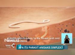 Ini Bahaya Cacing Parasit di Ikan Kaleng Makarel jika Termakan