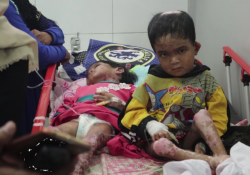Idap Penyakit Kulit Langka, Begini Kondisi Kakak-Adik asal Aceh
