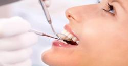 Makanan dan Minuman Ini Bisa Bikin Gigi Kuning