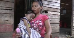 Tak Punya Biaya, Balita dengan Jantung Terbalik hanya Dirawat di Rumah