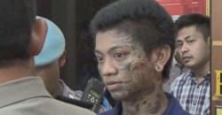 Pemuda 19 Tahun Aniaya Teman Semasa SD hingga Luka Parah