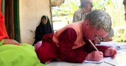 Anak Penderita Penyakit Langka Kulit Bersisik Butuh Bantuan Pengobatan