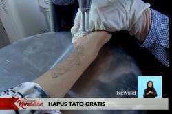 Komunitas Gerak Bareng Bantu Warga Hijrah dengan Hapus Tato Gratis