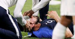 Beradu Tandukkan, Kepala Giroud Berlumuran Darah