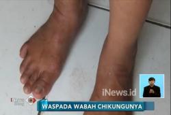 Terkena Gigitan Nyamuk Aedes Aegypti, 95 Warga Depok Terjangkit Penyakit Chikungunya