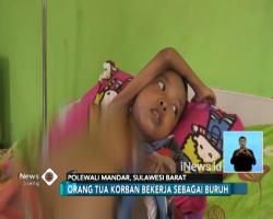 Kurus dan Buncit, Begini Kondisi Bocah Pengidap Malnutrisi di Polewali