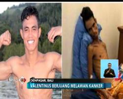 Kena Kanker, Petinju Indonesia Gagal Berlaga di Asian Games