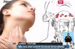 Kenali Ciri-Ciri Kanker Getah Bening