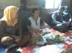 Bayi Penderita Pembengkakan Pembuluh Darah di Tapteng Butuh Bantuan