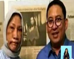 Ratna Sarumpaet Babak Belur, Fadli Zon Ungkap Penganiayaan Tersebut Keji