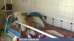 Kasus Bocah Dibakar dan Minum Air Seni di Tanjungbalai, Ini Kata KPAI
